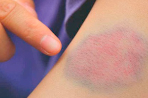 “Sebebsiz morluklar bazı sağlık sorunlarının habercisi olabilir”