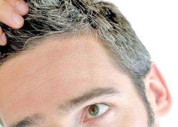 Stresin saçlarda etkili olduğu kanıtlandı