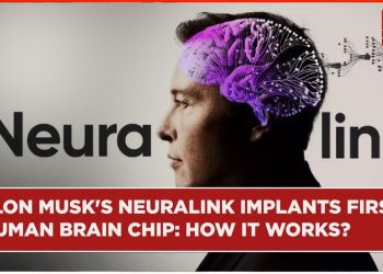 Elon Musk’ın, Neuralink girişimiyle ilk insan beynine çip yerleştirildi