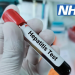 NHS, Hepatit C’yi yok etmek ‘bir saatlik’ karaciğer testini genişletiyor