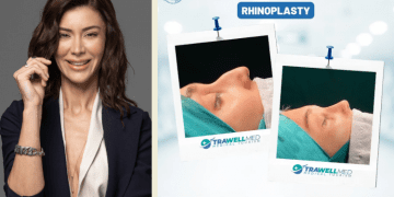 Trawellmed Sağlık Turizm Acentası kurucusundan önemli açıklamalar