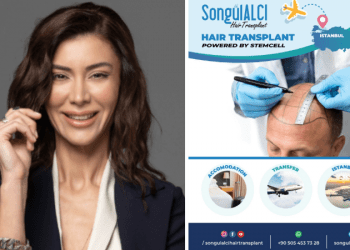 Saçlarımız da doğaya uyumludur; Türkiye’de saç ekimi zamanı