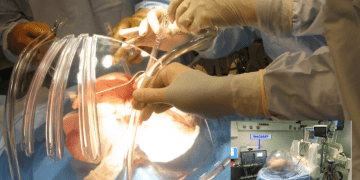 Donör organlarını canlandıran makine İngiltere’de ilk kez kullanıldı