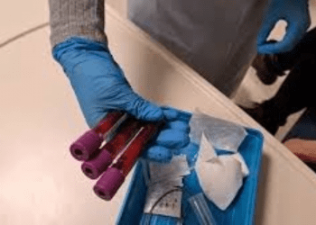 NHS’ten bunama hasta­ları için çığır aşabilecek deneme; kan testleri başladı