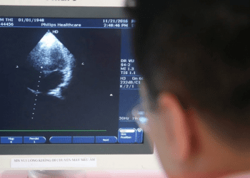 3D kalp taramaları NHS’te tanı koyma sürecini hızlandırıyor