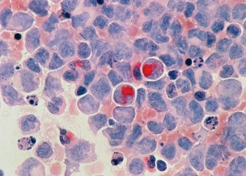 Chelsea, Ajax’ı paramparça etti: 5-1