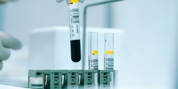 Harry Kane transfer ve Barcelona iddiası için konuştu