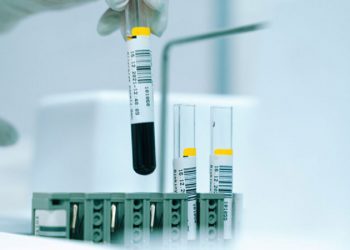 West Ham, FA Cup’ta Brentford’u penaltılarda geçti!