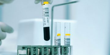 West Ham, FA Cup’ta Brentford’u penaltılarda geçti!